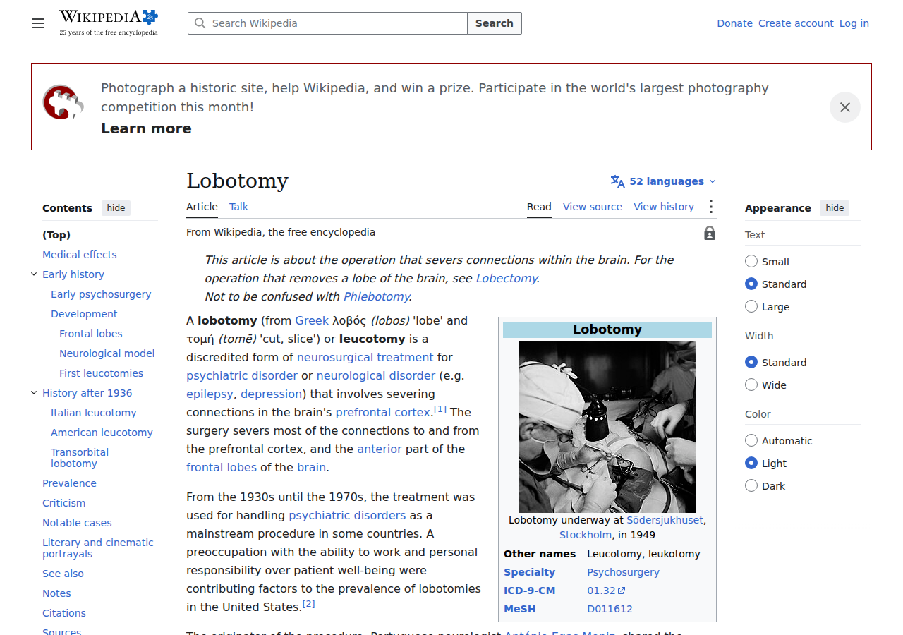 Wikipedia: Lobotomy — the Nobel Prize-winning surgical procedure that destroyed tens of thousands of lives